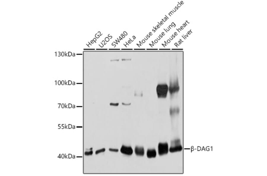 Western Blot - Anti-DAG1 Antibody (A12781) - Antibodies.com