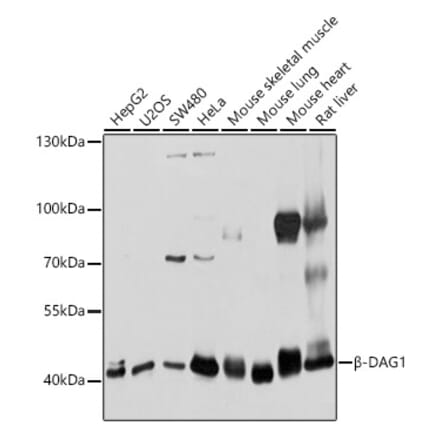 Western Blot - Anti-DAG1 Antibody (A12781) - Antibodies.com