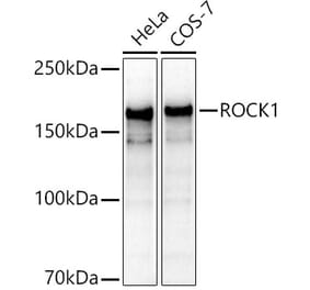 Western Blot - Anti-ROCK1 Antibody (A12783) - Antibodies.com
