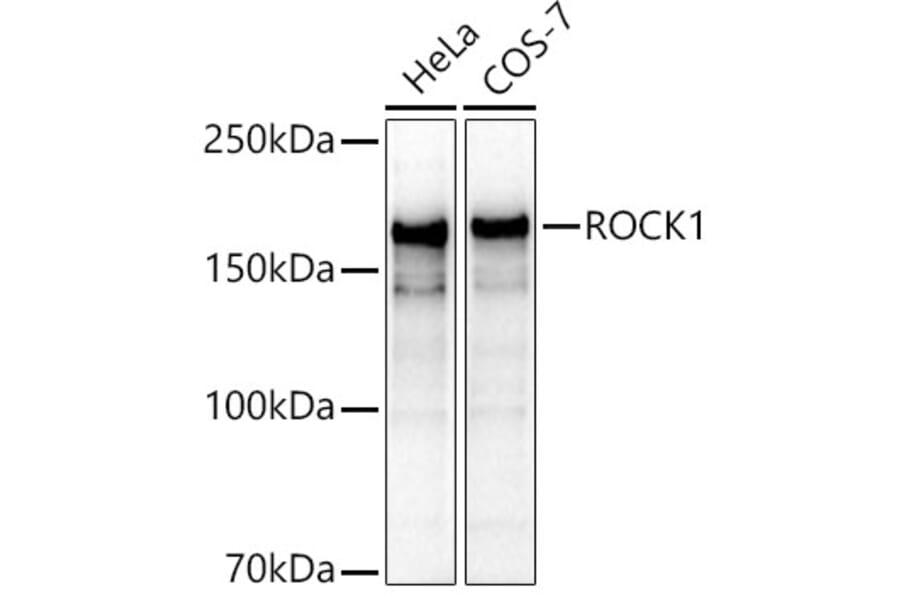 Western Blot - Anti-ROCK1 Antibody (A12783) - Antibodies.com