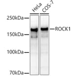 Western Blot - Anti-ROCK1 Antibody (A12783) - Antibodies.com