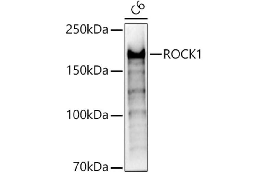 Western Blot - Anti-ROCK1 Antibody (A12783) - Antibodies.com