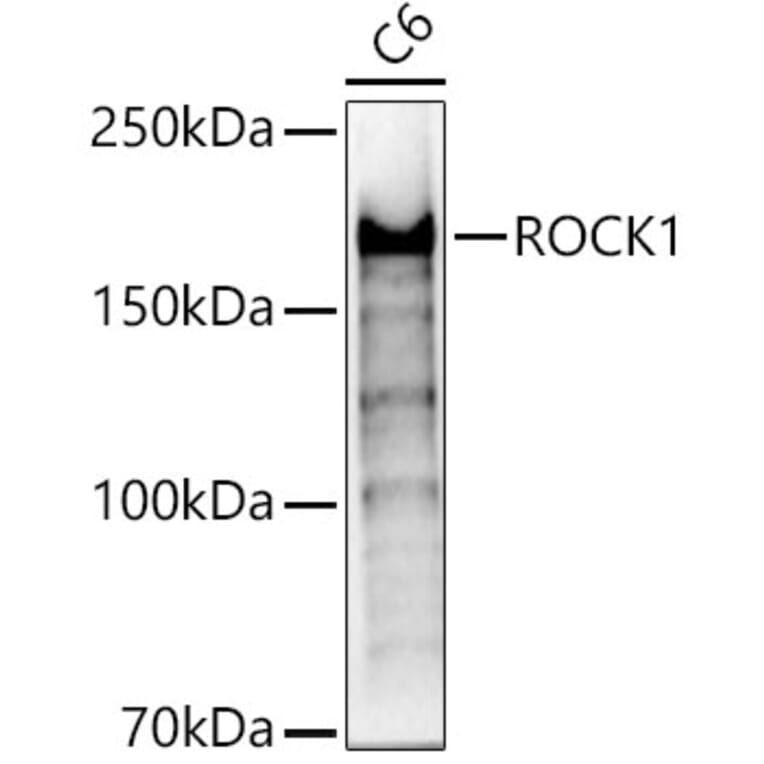 Western Blot - Anti-ROCK1 Antibody (A12783) - Antibodies.com