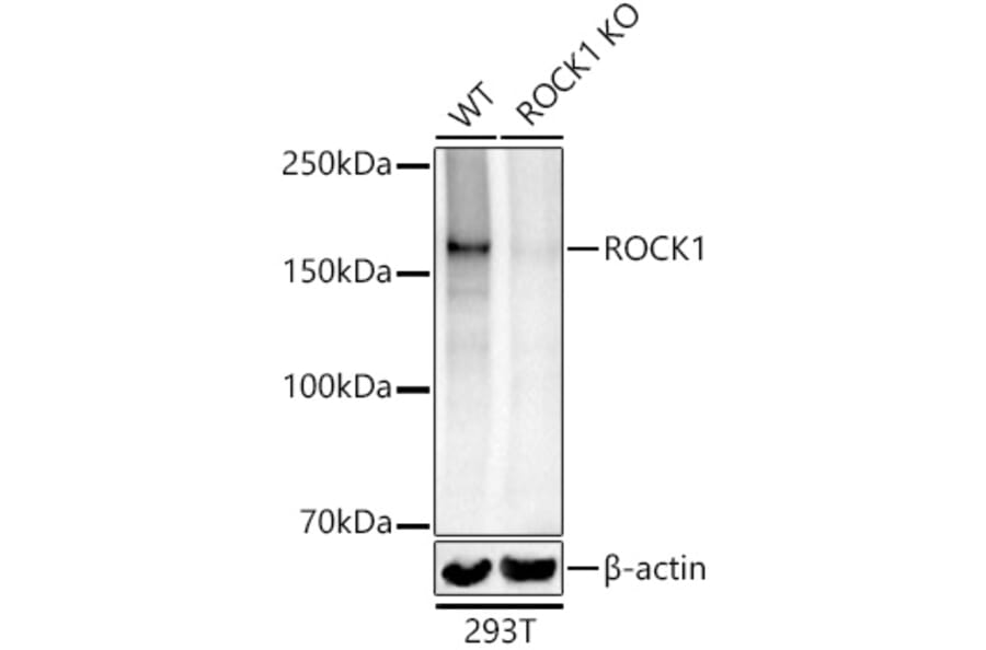Western Blot - Anti-ROCK1 Antibody (A12783) - Antibodies.com