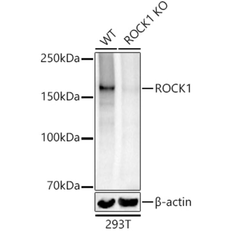 Western Blot - Anti-ROCK1 Antibody (A12783) - Antibodies.com