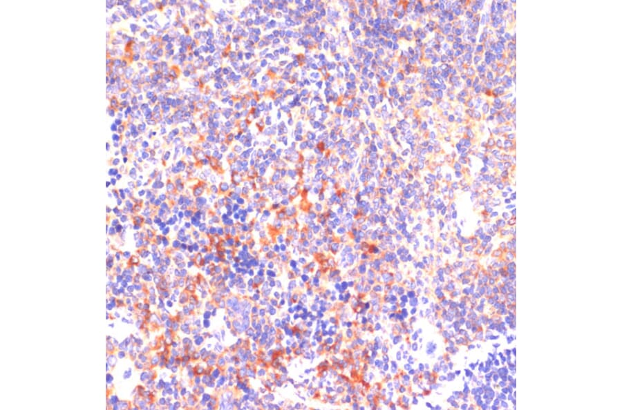 Immunohistochemistry - Anti-ROCK1 Antibody (A12783) - Antibodies.com