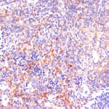 Immunohistochemistry - Anti-ROCK1 Antibody (A12783) - Antibodies.com