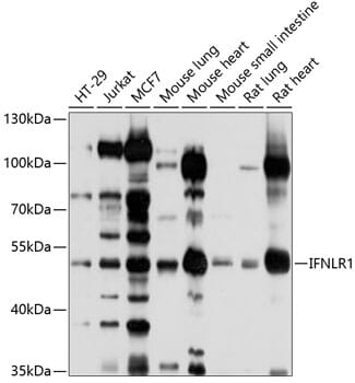 Western blot analysis of extracts of various cell lines, using Anti-IFNLR1 Antibody (A10082) at 1:1,000 dilution.
Secondary antibody: Goat Anti-Rabbit IgG (H+L) (HRP) (AS014) at 1:10,000 dilution.
Lysates / proteins: 25µg per lane.
Blocking buffer: 3% non-fat dry milk in TBST.
Detection: ECL Basic Kit (RM00020).
Exposure time: 10s.