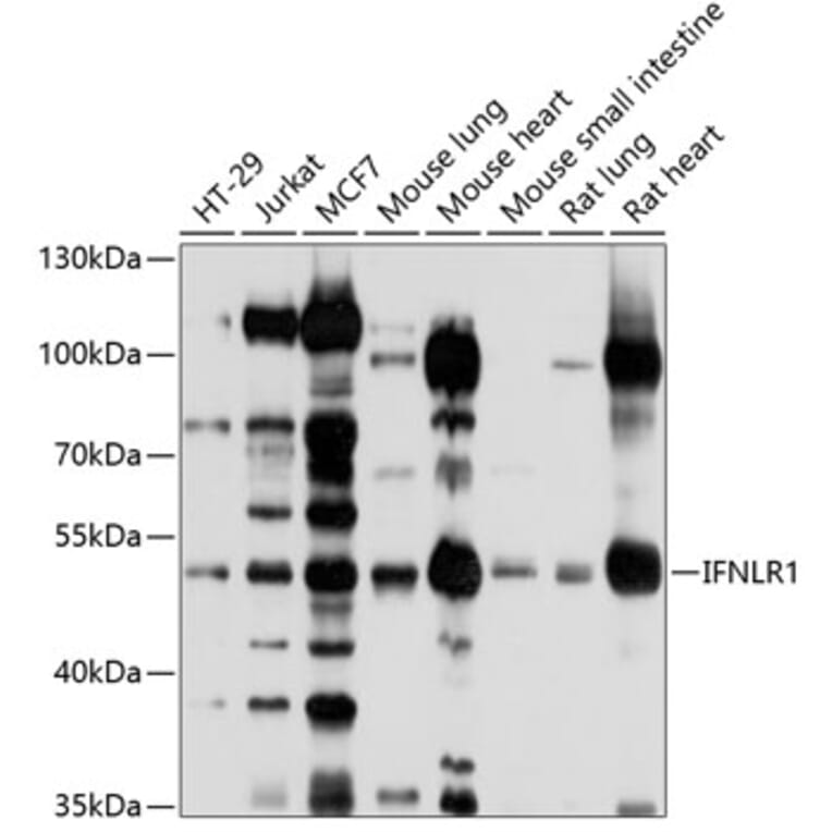 Western Blot - Anti-IL28RA Antibody (A12785) - Antibodies.com