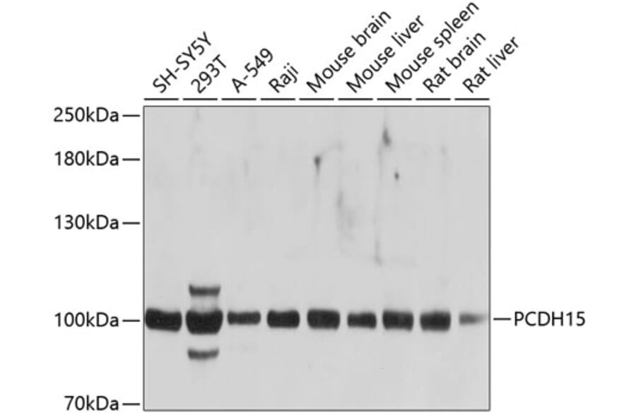 Western Blot - Anti-PCDH15 Antibody (A12786) - Antibodies.com