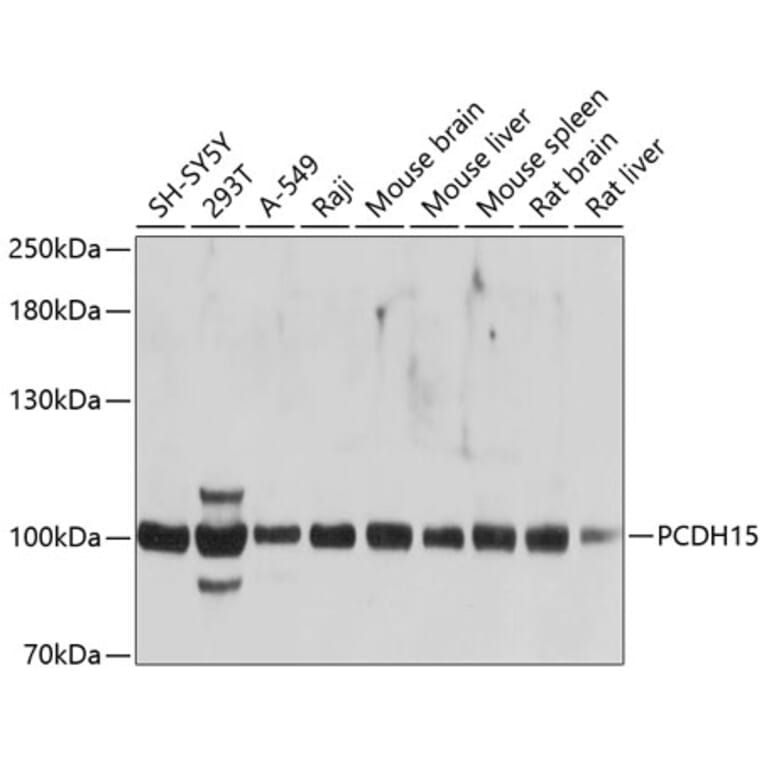 Western Blot - Anti-PCDH15 Antibody (A12786) - Antibodies.com