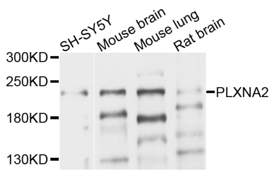 Western Blot - Anti-PLXNA2 Antibody (A10087) - Antibodies.com
