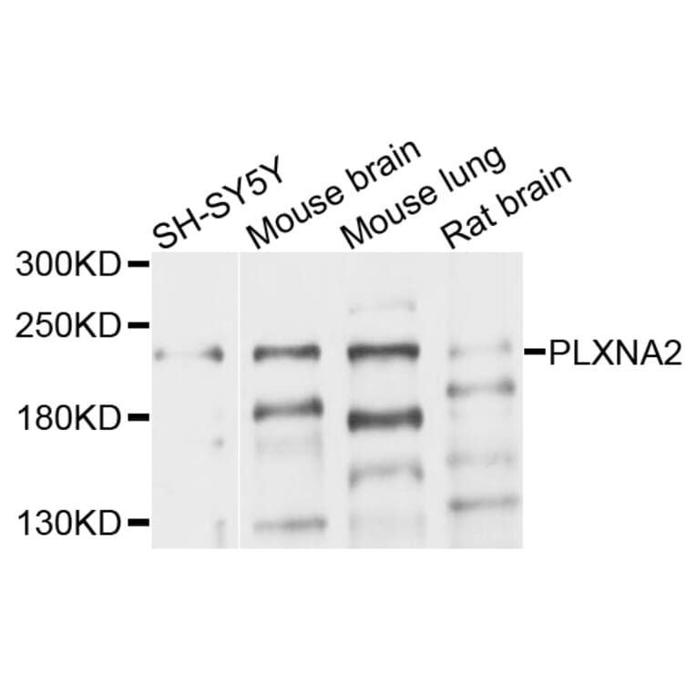 Western Blot - Anti-PLXNA2 Antibody (A10087) - Antibodies.com
