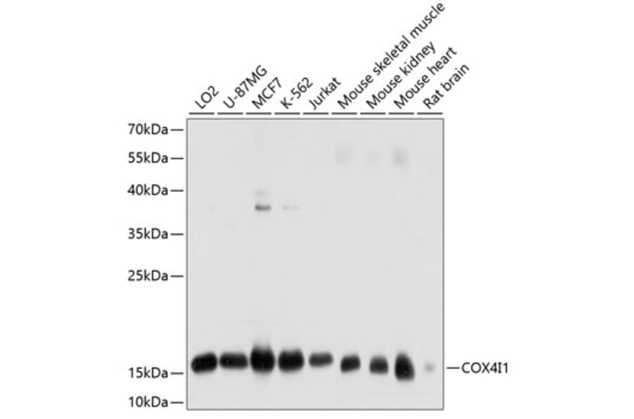 Western Blot - Anti-COX4I1 Antibody (A10098) - Antibodies.com