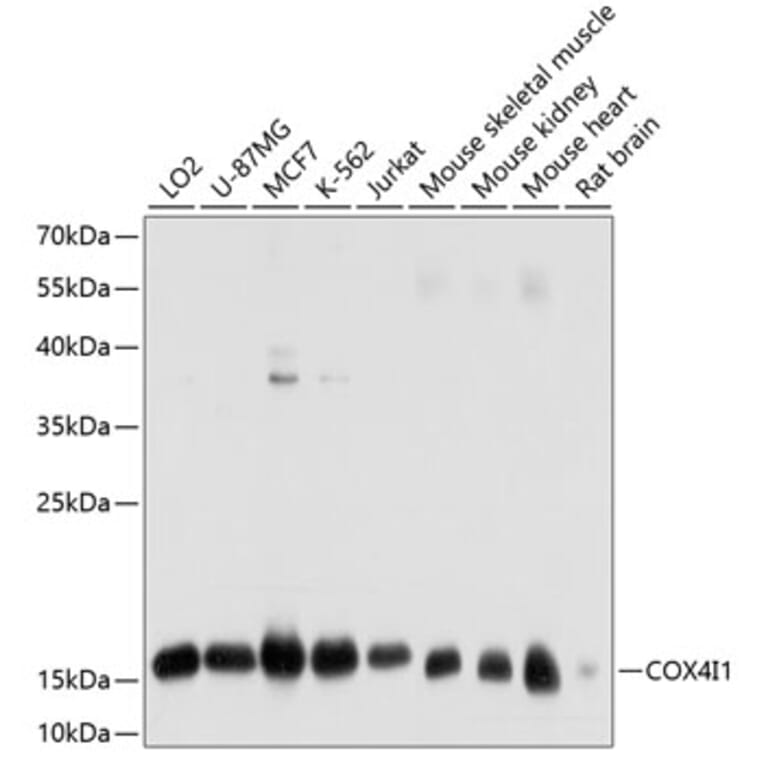 Western Blot - Anti-COX4I1 Antibody (A10098) - Antibodies.com