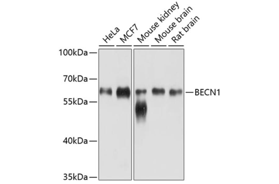 Western Blot - Anti-BECN1 Antibody (A10101) - Antibodies.com