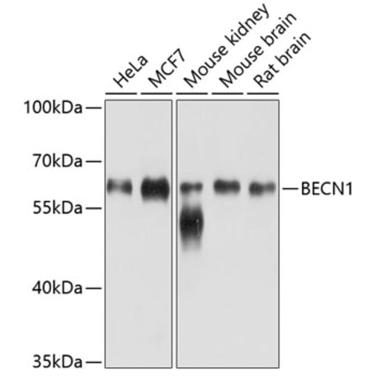 Western Blot - Anti-BECN1 Antibody (A10101) - Antibodies.com