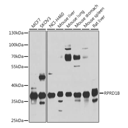 Western Blot - Anti-C20orf77 Antibody (A12792) - Antibodies.com