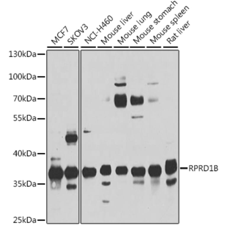 Western Blot - Anti-C20orf77 Antibody (A12792) - Antibodies.com