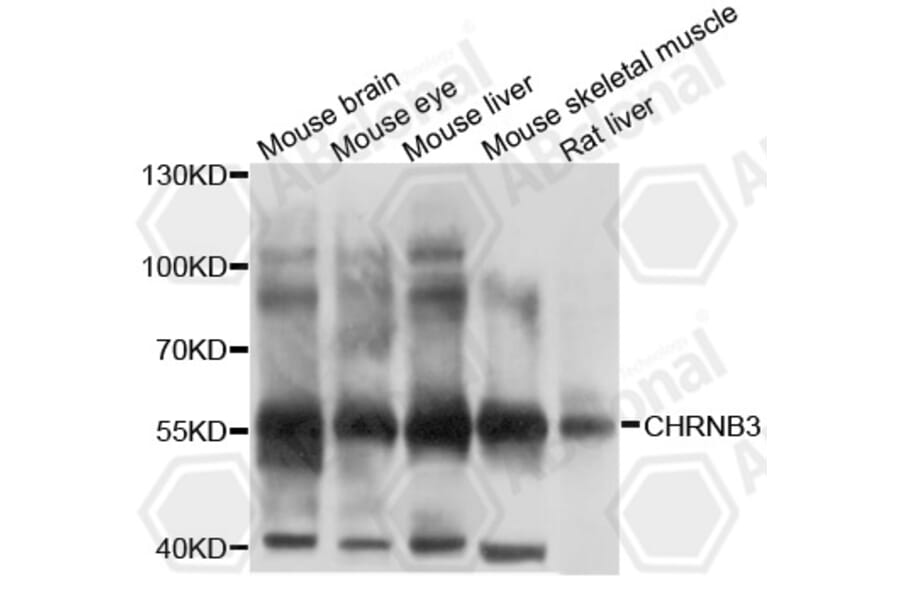 Western Blot - Anti-CHRNB3 Antibody (A10108) - Antibodies.com