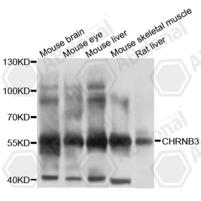 Western Blot - Anti-CHRNB3 Antibody (A10108) - Antibodies.com