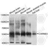Western Blot - Anti-CHRNB3 Antibody (A10108) - Antibodies.com