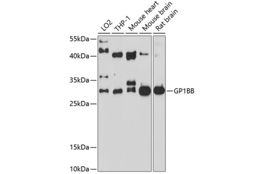 Western Blot - Anti-CD42c/GP1BB Antibody (A12794) - Antibodies.com