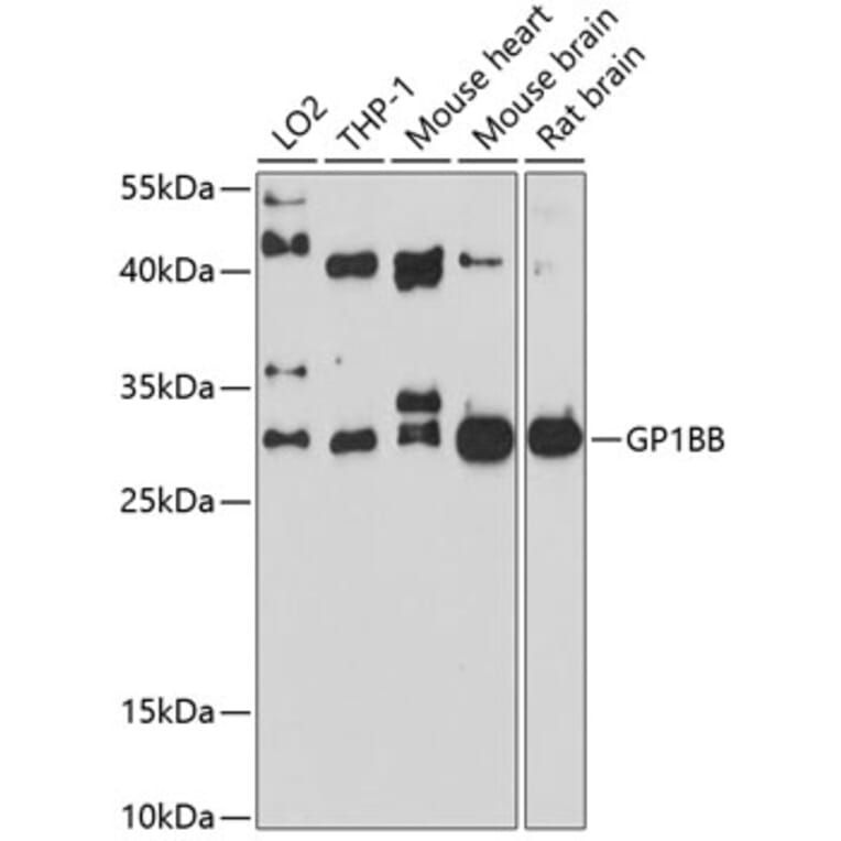 Western Blot - Anti-CD42c/GP1BB Antibody (A12794) - Antibodies.com