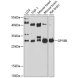 Western Blot - Anti-CD42c/GP1BB Antibody (A12794) - Antibodies.com