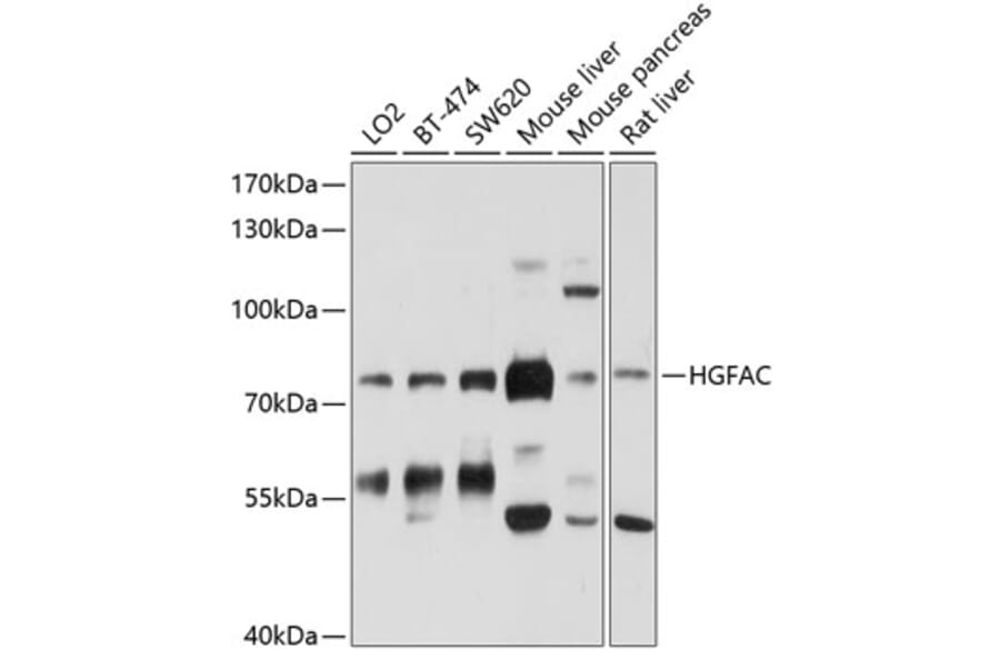 Western Blot - Anti-HGFactivator Antibody (A12795) - Antibodies.com