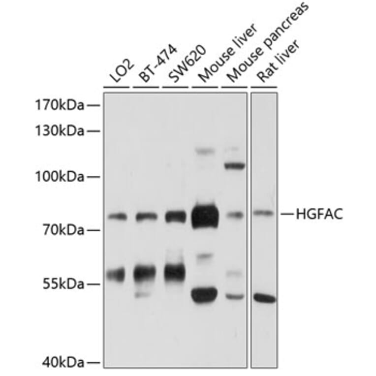 Western Blot - Anti-HGFactivator Antibody (A12795) - Antibodies.com