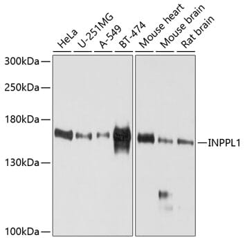 Western blot analysis of extracts of various cell lines, using Anti-INPPL1 Antibody (A10115) at 1:1,000 dilution.
Secondary antibody: Goat Anti-Rabbit IgG (H+L) (HRP) (AS014) at 1:10,000 dilution.
Lysates / proteins: 25µg per lane.
Blocking buffer: 3% non-fat dry milk in TBST.
Detection: ECL Basic Kit (RM00020).
Exposure time: 60s.