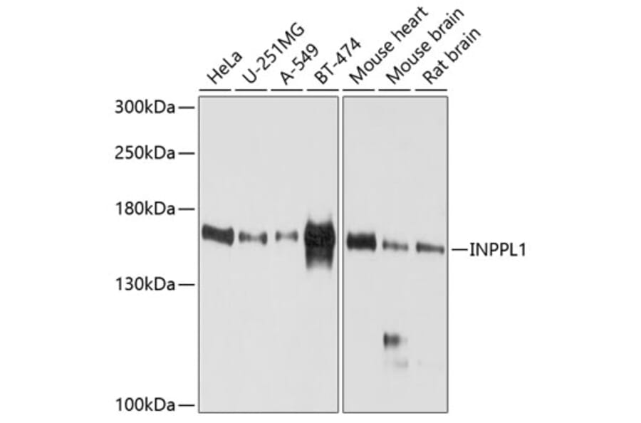 Western Blot - Anti-INPPL1/SHIP-2 Antibody (A12796) - Antibodies.com