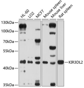 Western blot analysis of extracts of various cell lines, using Anti-KIR3DL2 Antibody (A10117) at 1:1,000 dilution.
Secondary antibody: Goat Anti-Rabbit IgG (H+L) (HRP) (AS014) at 1:10,000 dilution.
Lysates / proteins: 25µg per lane.
Blocking buffer: 3% non-fat dry milk in TBST.
Detection: ECL Basic Kit (RM00020).
Exposure time: 60s.