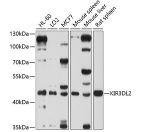 Western Blot - Anti-KIR3DL2 Antibody (A12797) - Antibodies.com