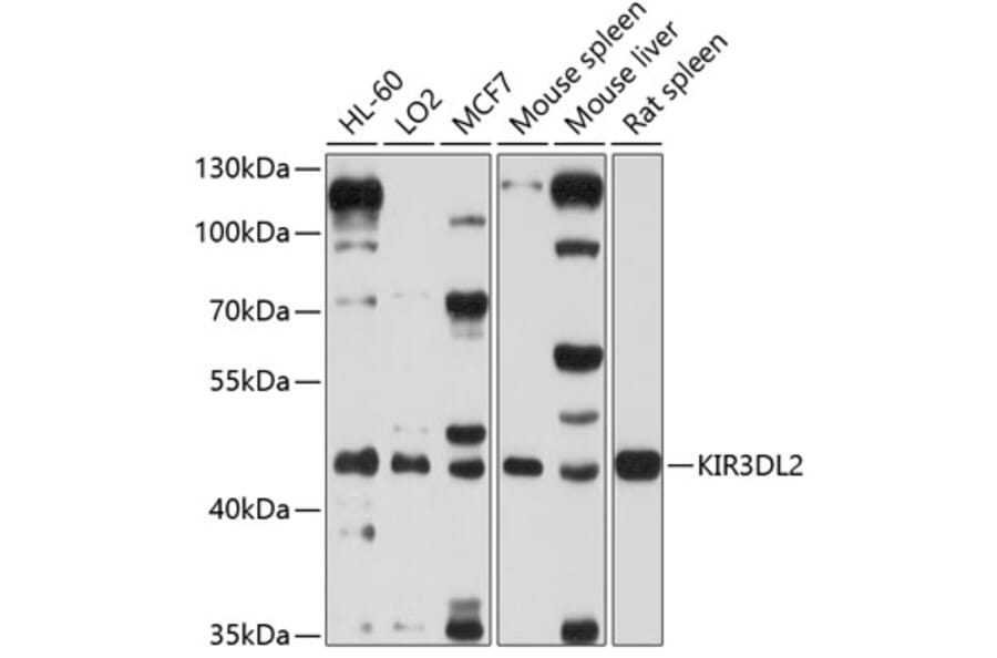 Western Blot - Anti-KIR3DL2 Antibody (A12797) - Antibodies.com