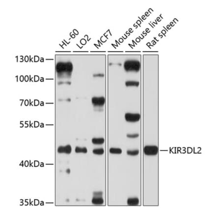 Western Blot - Anti-KIR3DL2 Antibody (A12797) - Antibodies.com