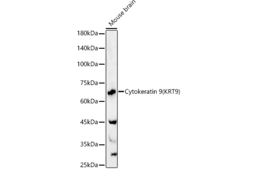 Western Blot - Anti-Cytokeratin 9 Antibody (A12798) - Antibodies.com