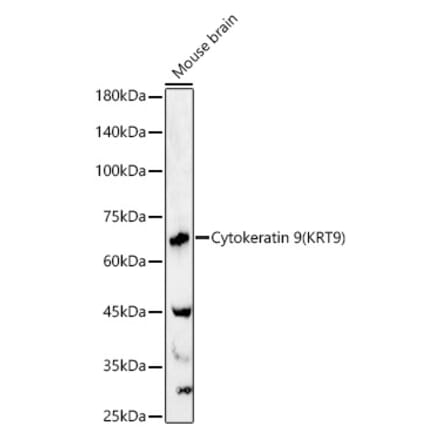 Western Blot - Anti-Cytokeratin 9 Antibody (A12798) - Antibodies.com