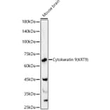 Western Blot - Anti-Cytokeratin 9 Antibody (A12798) - Antibodies.com