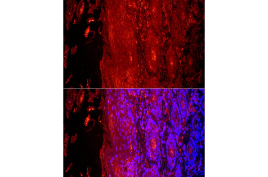 Immunofluorescence - Anti-Cytokeratin 9 Antibody (A12798) - Antibodies.com