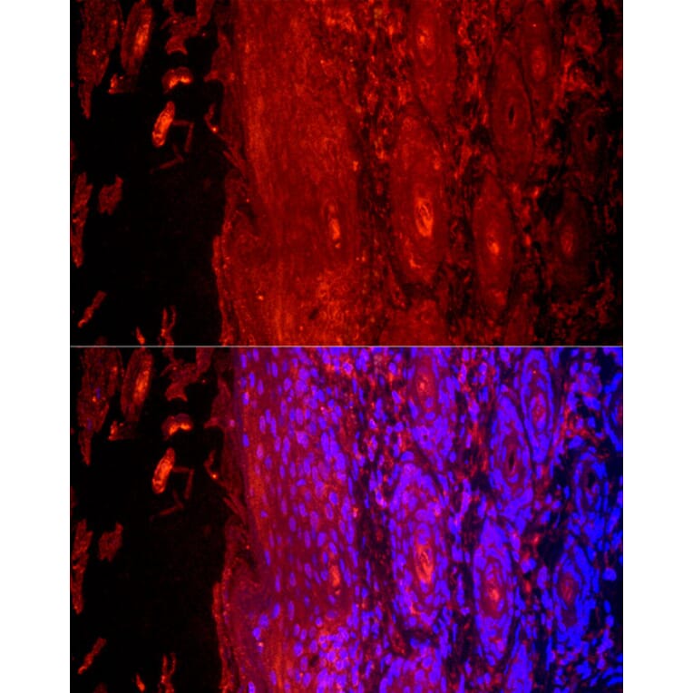 Immunofluorescence - Anti-Cytokeratin 9 Antibody (A12798) - Antibodies.com