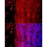 Immunofluorescence - Anti-Cytokeratin 9 Antibody (A12798) - Antibodies.com