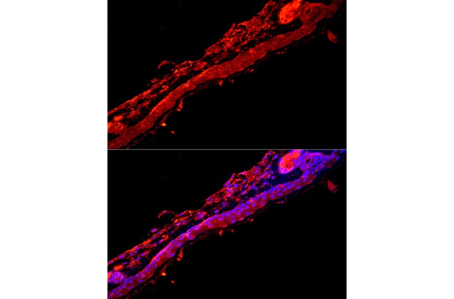 Immunofluorescence - Anti-Cytokeratin 9 Antibody (A12798) - Antibodies.com