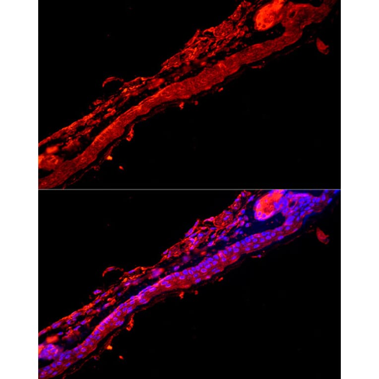 Immunofluorescence - Anti-Cytokeratin 9 Antibody (A12798) - Antibodies.com