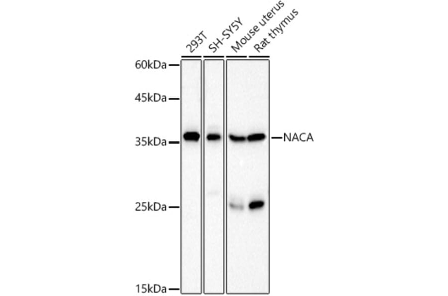 Western Blot - Anti-NACA1 Antibody (A12800) - Antibodies.com