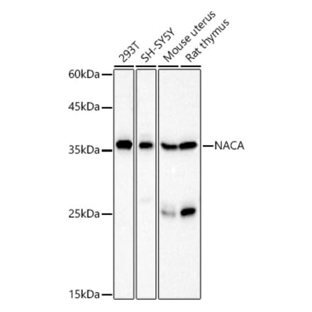 Western Blot - Anti-NACA1 Antibody (A12800) - Antibodies.com