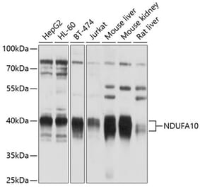 Western Blot - Anti-NDUFA10 Antibody (A12801) - Antibodies.com