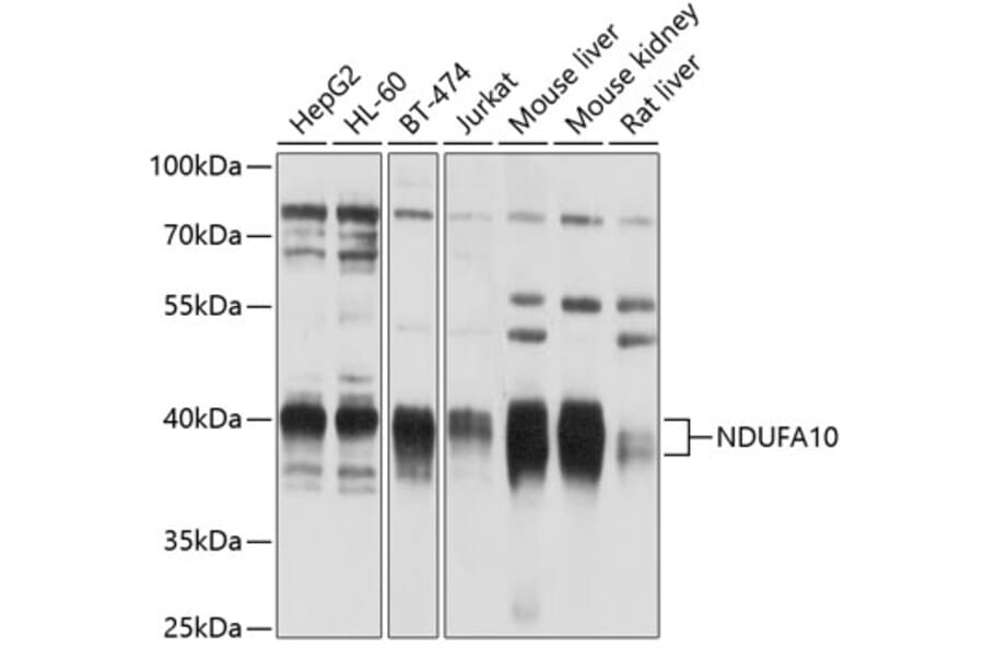 Western Blot - Anti-NDUFA10 Antibody (A12801) - Antibodies.com