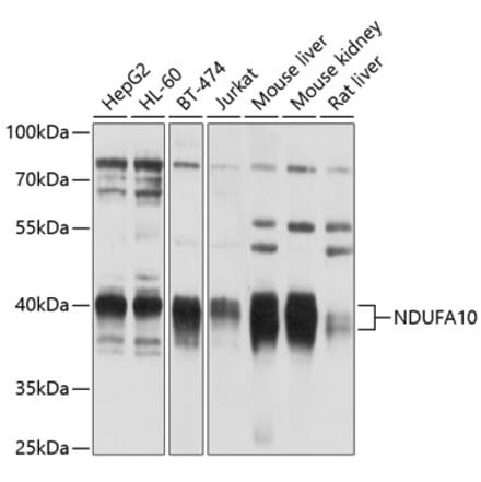 Western Blot - Anti-NDUFA10 Antibody (A12801) - Antibodies.com